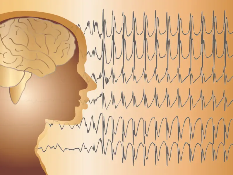 Epilepsija - simptomi, uzroci i komplikacije
